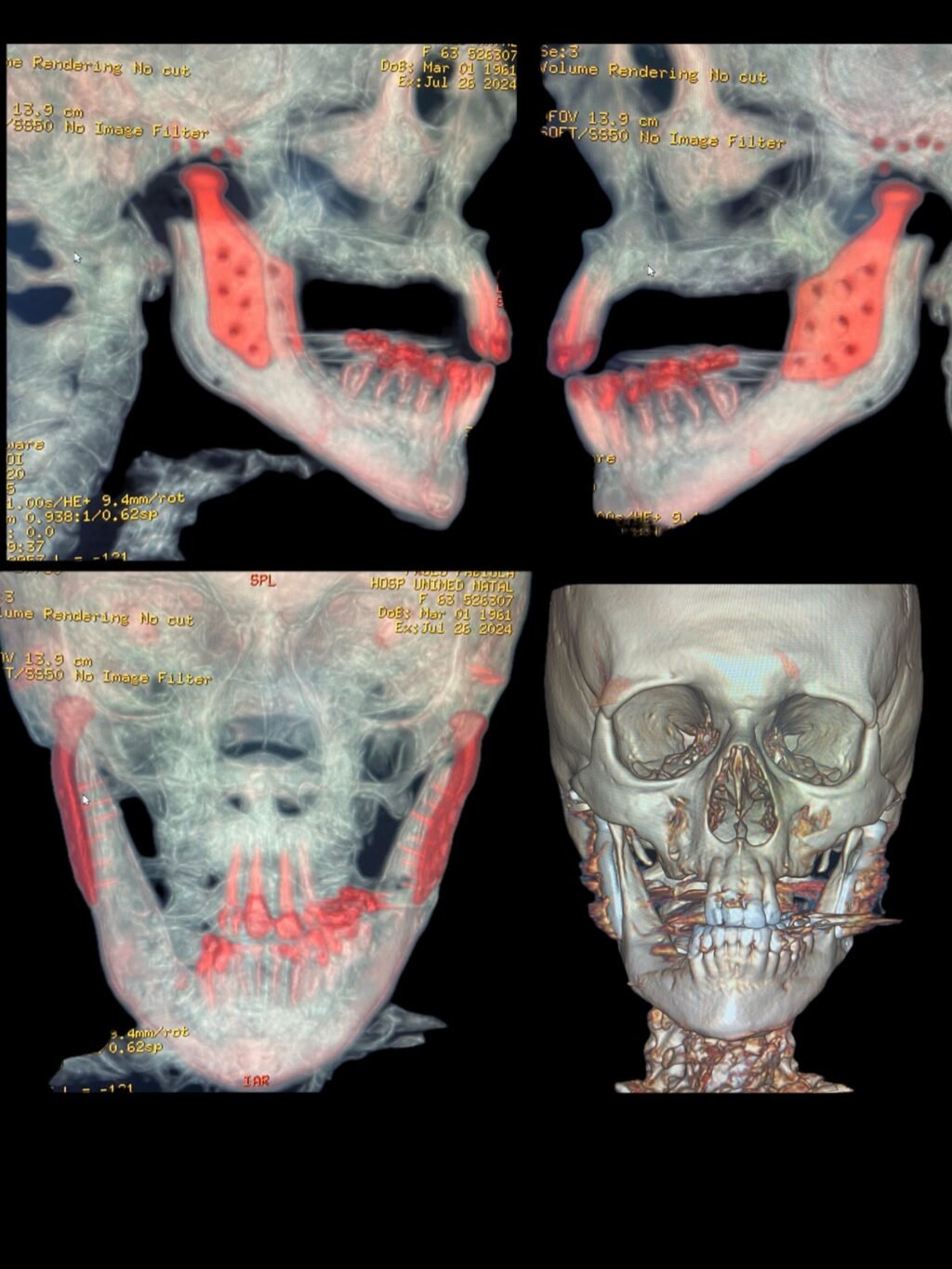 Instagram post from jimmybarbalho. This post is in position 14.